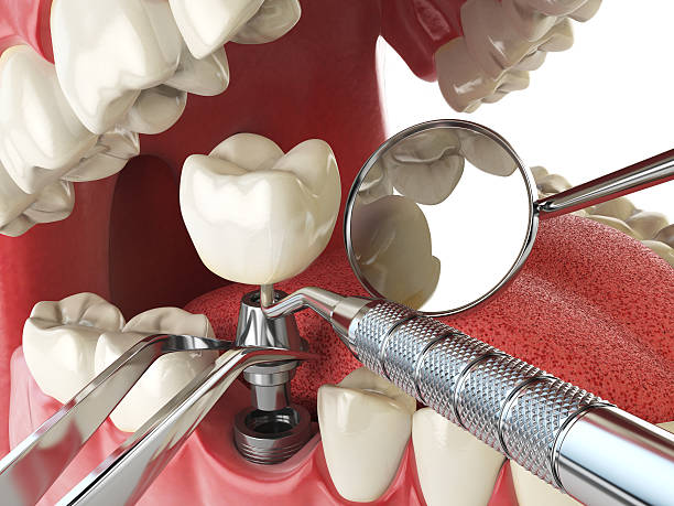 Best Weekend Emergency Dentist in Fostoria, OH