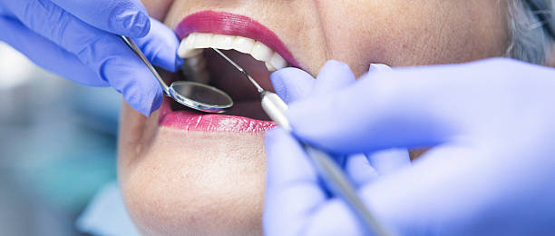 Best Broken or Cracked Tooth Emergency Dentist in Fostoria, OH